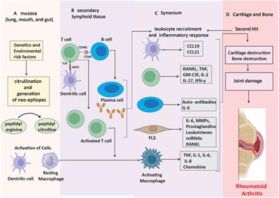 Noncoding RNAs in rheumatoid arthritis: modulators of the NF-κB signaling pathway and therapeutic implications